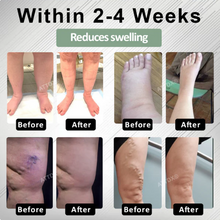 Load image into Gallery viewer, ATTDX® FlowBoost Edema Drain Herbal Roll On