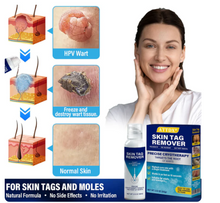 Load image into Gallery viewer, ATTDX® TagRecede Cryo Treatment Spray