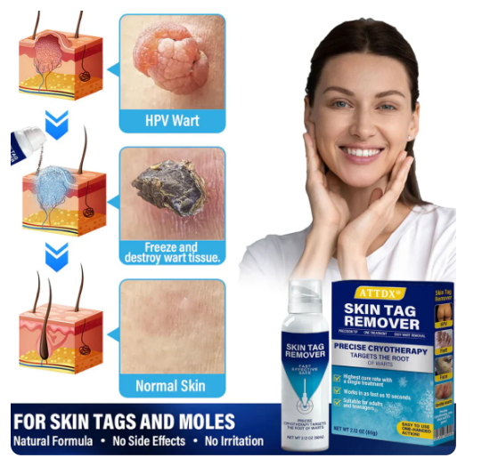 ATTDX® TagRecede Cryo Treatment Spray