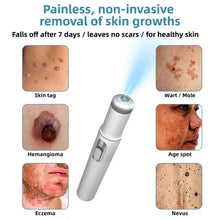 Load image into Gallery viewer, Bikenda® 🔥🔥 Non-Invasive Mole and Wart Removal Laser Pen
